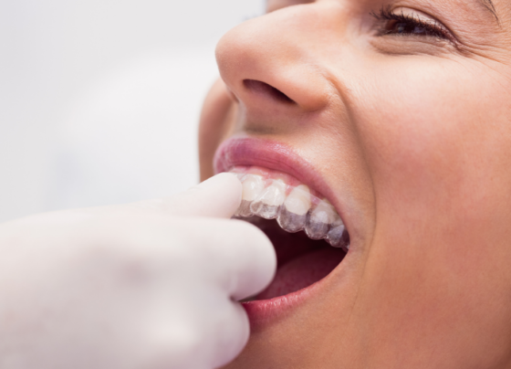 How Much Do Full Mouth Dental Implants Cost in Dubai