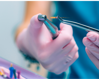 Emergency Root Canal Treatment in Dubai by Dubai professional dentist