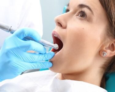 Facial Swelling After a Root Canal: When Dubai Patients Should Worry