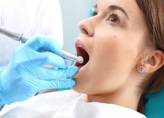 Facial Swelling After a Root Canal: When Dubai Patients Should Worry