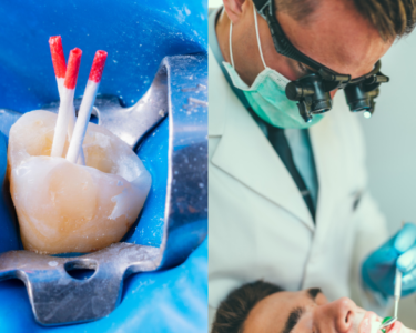 What Happens If You Delay a Root Canal in Dubai