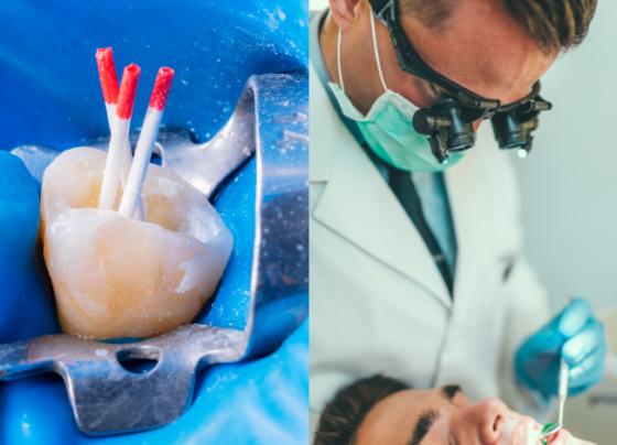 What Happens If You Delay a Root Canal in Dubai