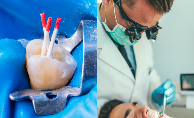 What Happens If You Delay a Root Canal in Dubai?