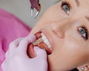 What Is a Tooth Abscess and How Serious Is It