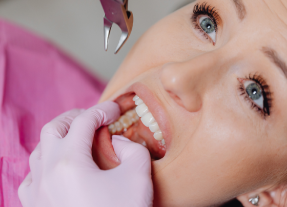 What Is a Tooth Abscess and How Serious Is It