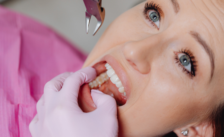 What Is a Tooth Abscess and How Serious Is It? Dubai Patient Guide