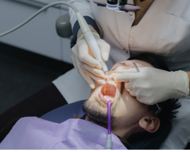 What Type of Dentist Performs Root Canals in Dubai?