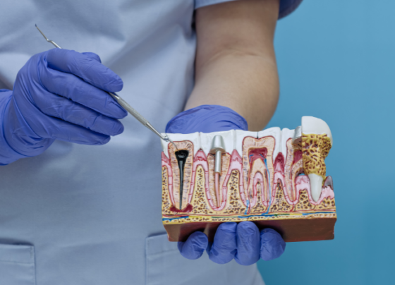 do I need a root canal or filling